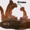 stroma